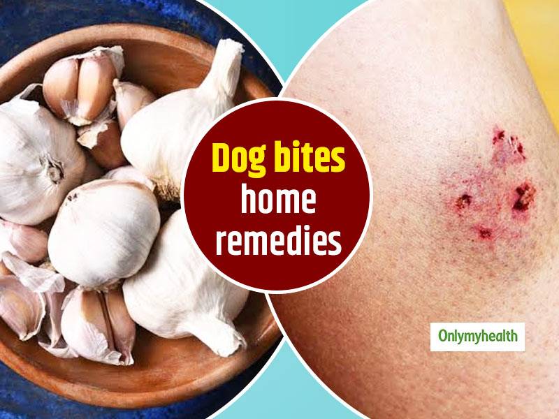 How To Treat A Dog Bite Naturally? Check Out These 7 Home Remedies